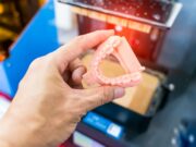 L’imprimante dentaire 3D : fonctionnement, avantages ?
